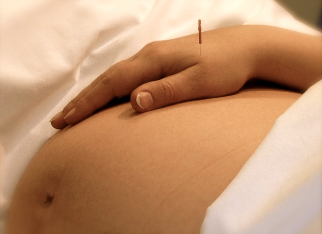 acupuncture and pregnancy